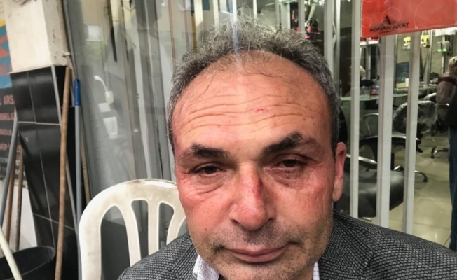 CHP’li Belediye Başkan Yardımcısına saldırı anı güvenlik kamerasında